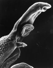 A parasitic worm that causes schistosomiasis